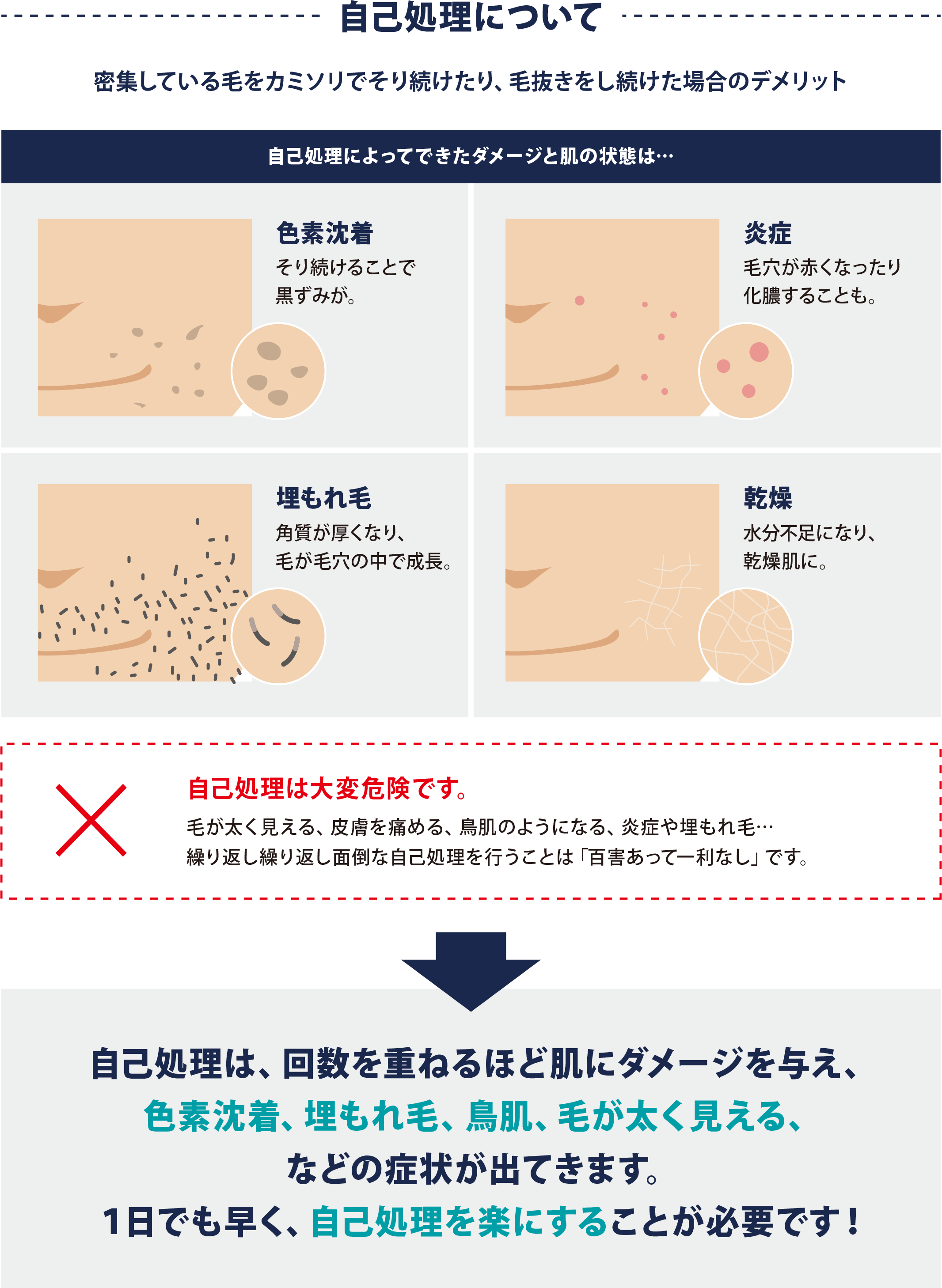 光脱毛 フーレセラピーサロンtiratore 公式